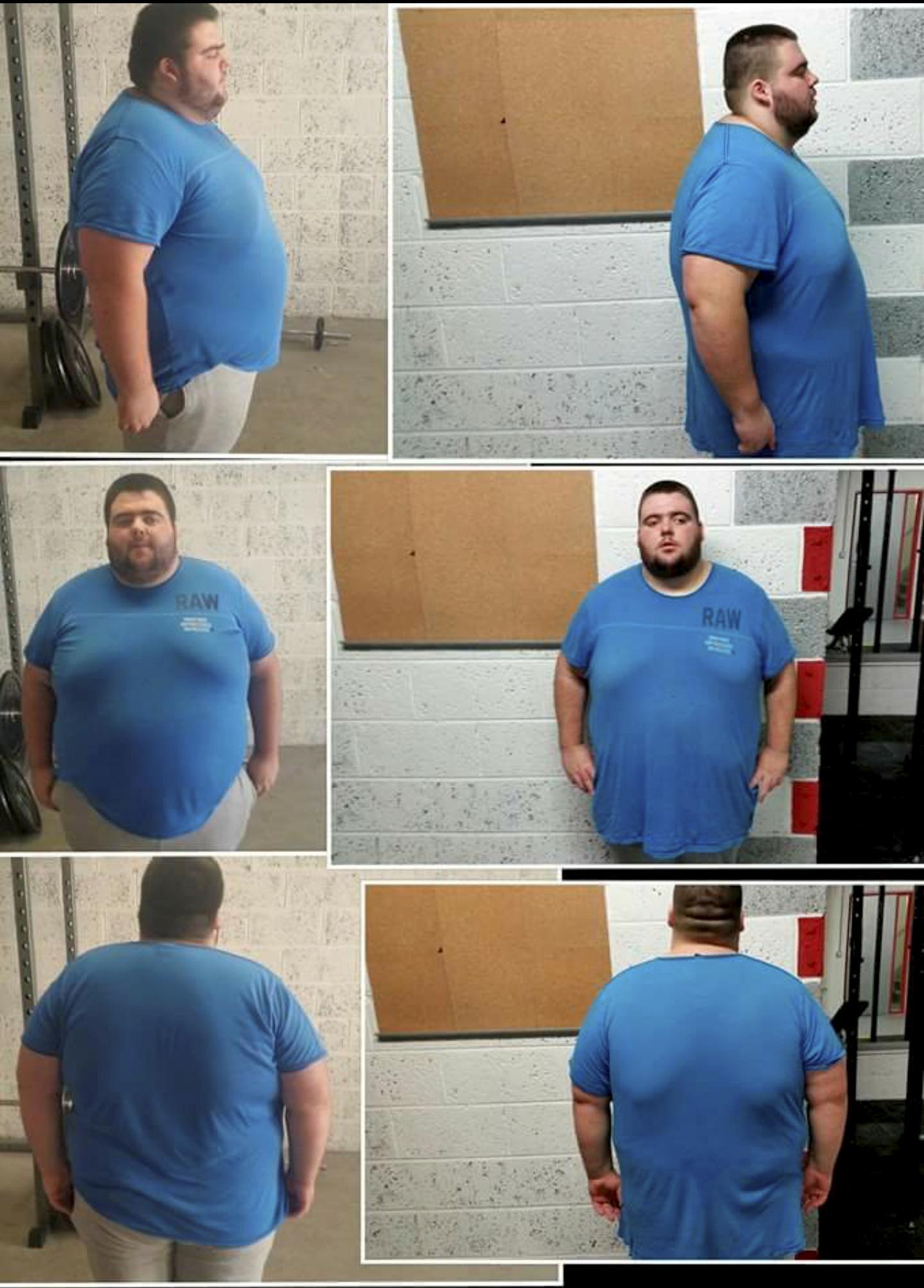 Dylan Condron, 21 wearing the 6XL T shirt before his weightloss. See Masons copy MN6XL: A superslimmer has lost an amazing 20 STONE after struggling to fit into a shirt that was SIX times extra-large. Dylan Condron, 21, left the scales groaning at a massive 33 stone after gorging on carbs when he failed to find work. But he shamed himself into his stunning weight loss when a neighbour bought him the XXXXXXL t-shirt back from holiday and it was too tight. He switched to a high-protein diet combined with a gruelling "caveman" gym programme and has dropped to a healthy 13 stone in two years.