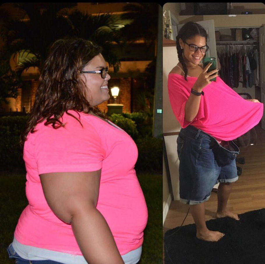 "I’m 5’4 and I have lost over 170 lbs with diet and exercise. 