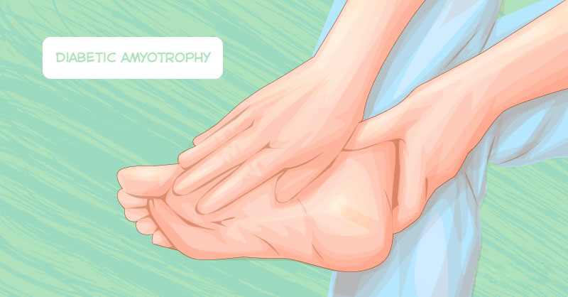 Diabetic Neuropathy: The Symptoms And How To Prevent This Condition