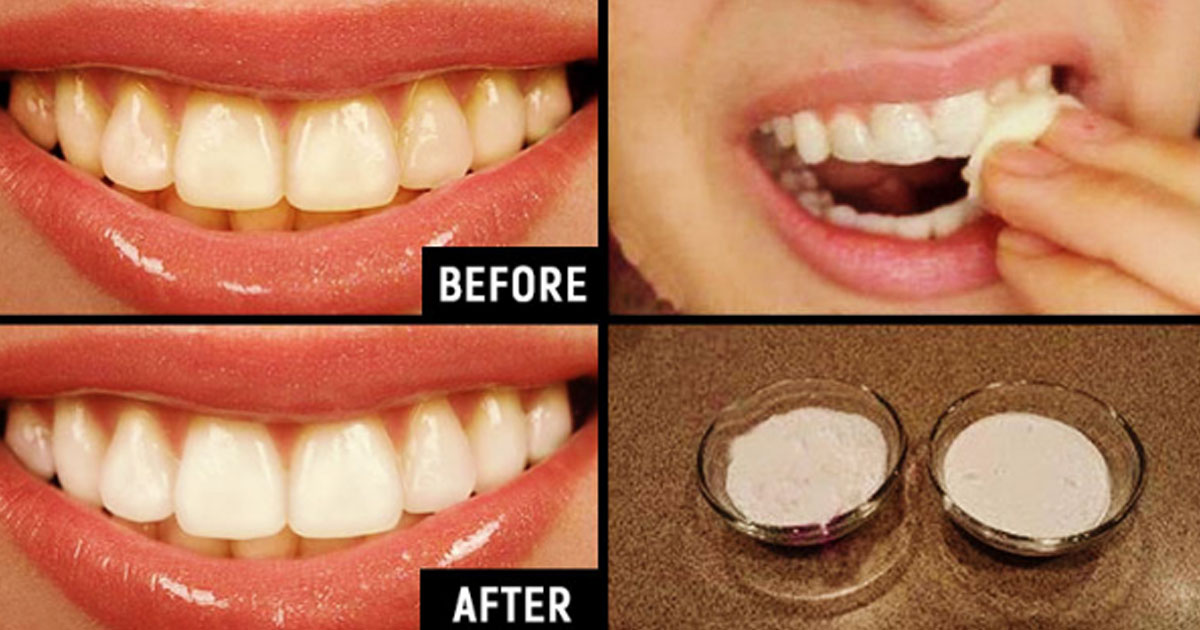 8 Ways To Cheaply And Naturally Whiten Teeth (Without Destroying Your