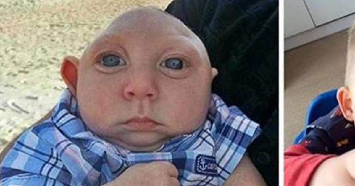 A Boy Born With No Brain Shocked The Doctors! This Is What He Looks ...