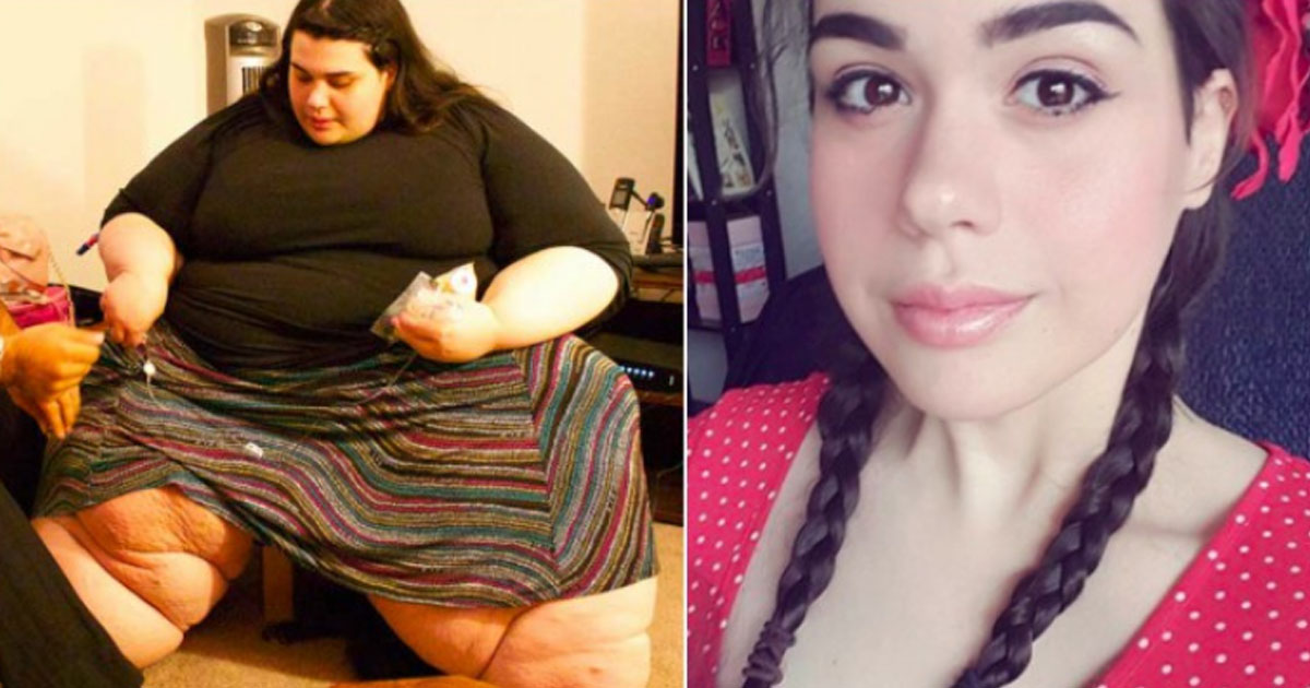 Morbidly Obese 23-Year-Old Woman Loses 400 Pounds After Changing Only ...